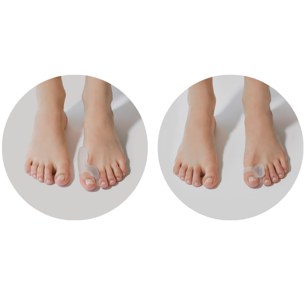 Κοτσι στο ποδι