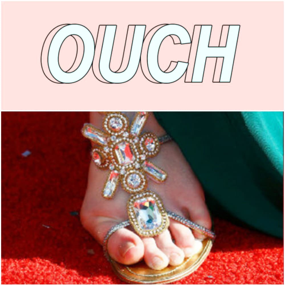 Foot with bunion collage